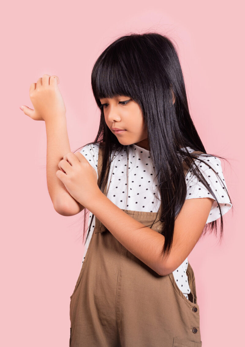 Pieni tummahiuksinen aasialaisen näköinen tyttö raapii kyynärtaivetta.